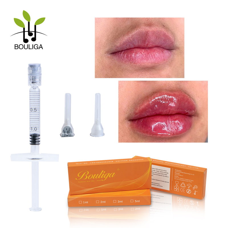 Volumizing Non-cross-linked Augmentation Lip Fillers