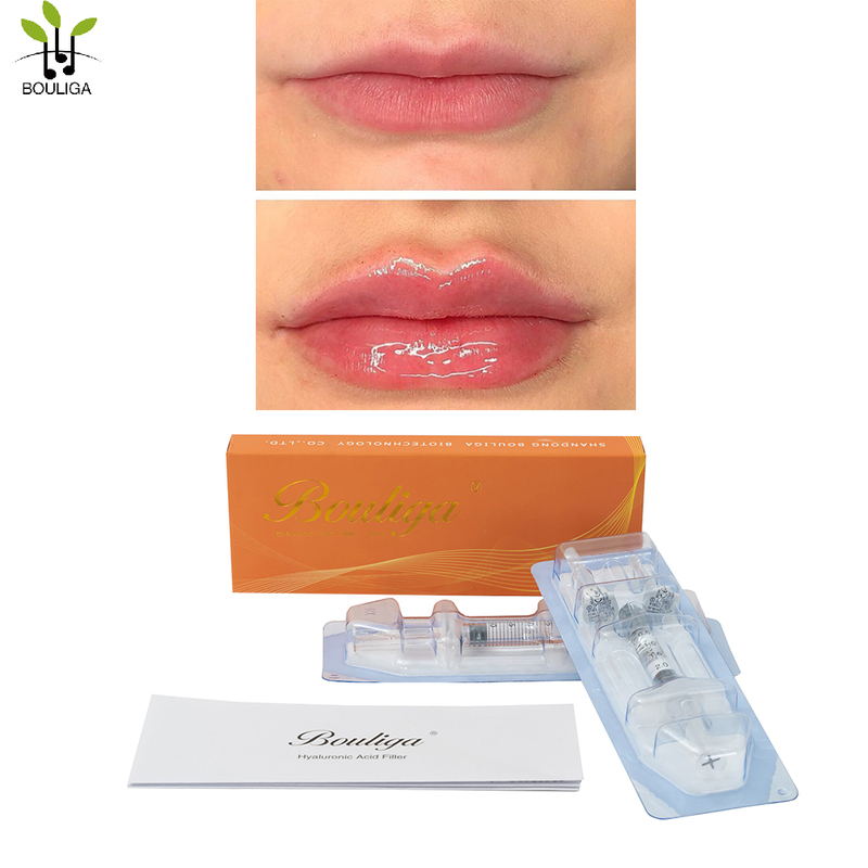 Bouliga 100% pure Hyaluronci Acid Dermal Filler 2ml 24mg/ml high Concentration for Lip no pain 