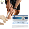 Bouliga Knee Filler Relieve Joint Pain - Non Cross Linked HA 60mg/3ml 