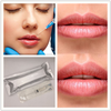 Lip Augmentation Filler Hyaluronic Acid Dermal Injection