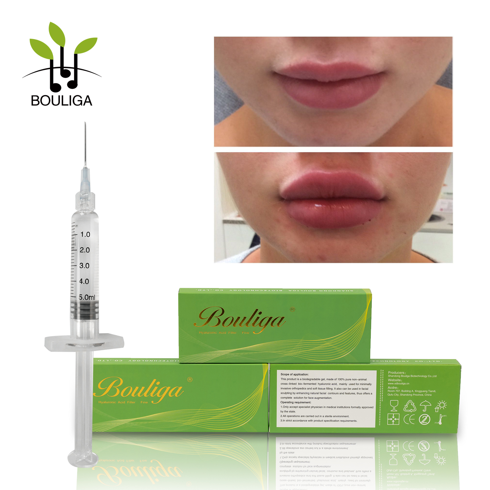 Pure Crosslinked Hyaluronic Acid Dermal Fillers for Lips Enhancement 