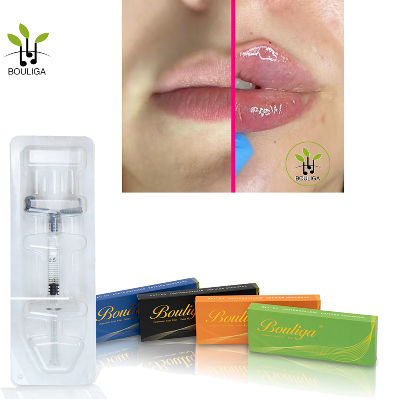 Luscious Lips Enhancing Dermal Filler by Bouliga(1ml 2ml 5ml )