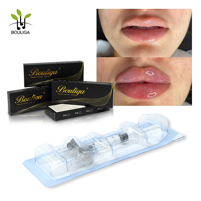Factory Supply Injectable Hyaluronic Acid Dermal Filler for Wrinkles lip filler 1ml Deep