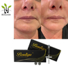 Nasolabial Fold Filling Wrinkle Reduction Facial Fillers