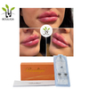 Lip Augmentation Volume Restoration Facial Fillers