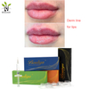 Bouliga Non-surgical Enhance Lips Filler 5ml Dermal Filler Non-Surgical 