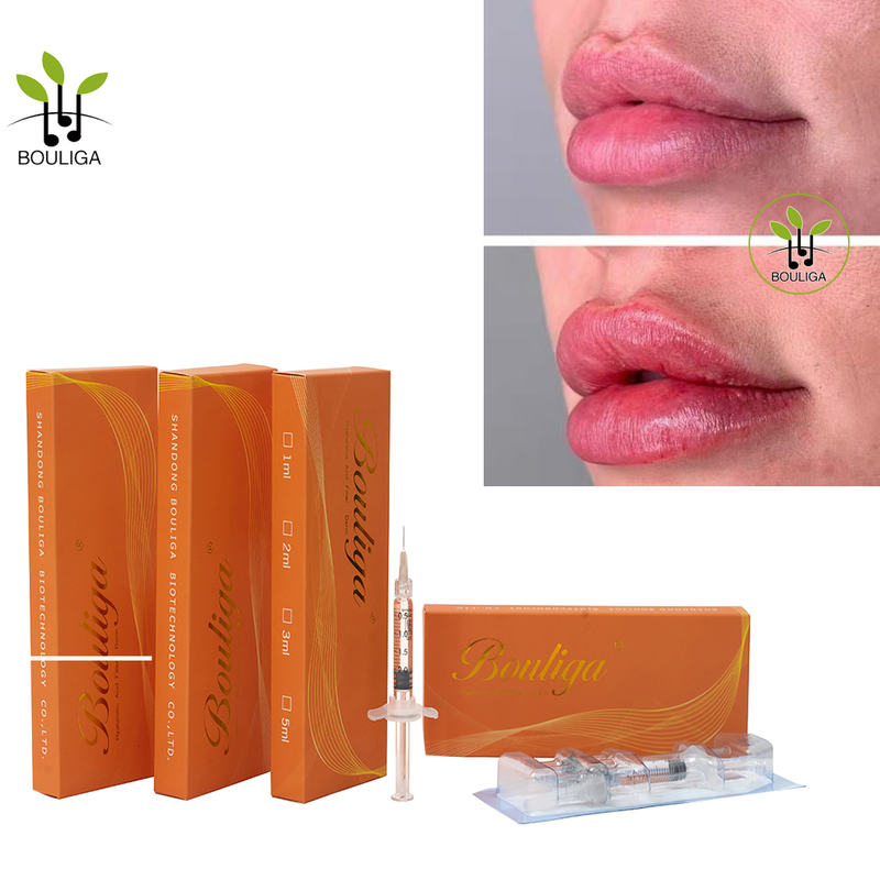 Bouliga Lip Plumper 1ml 2ml 5ml Dermal Filler