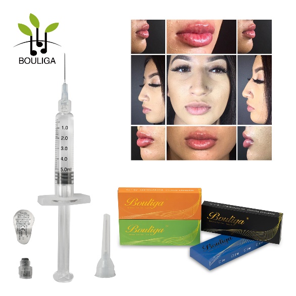 Injectable1ml 2ml 3ml 5ml Crosslinked Hyaluronic Acid Injecions Dermal Filler/Ha Filler for Lips, Nose, Wrinkles, Breast, Buttocks, Body, Face, Neck, Folds