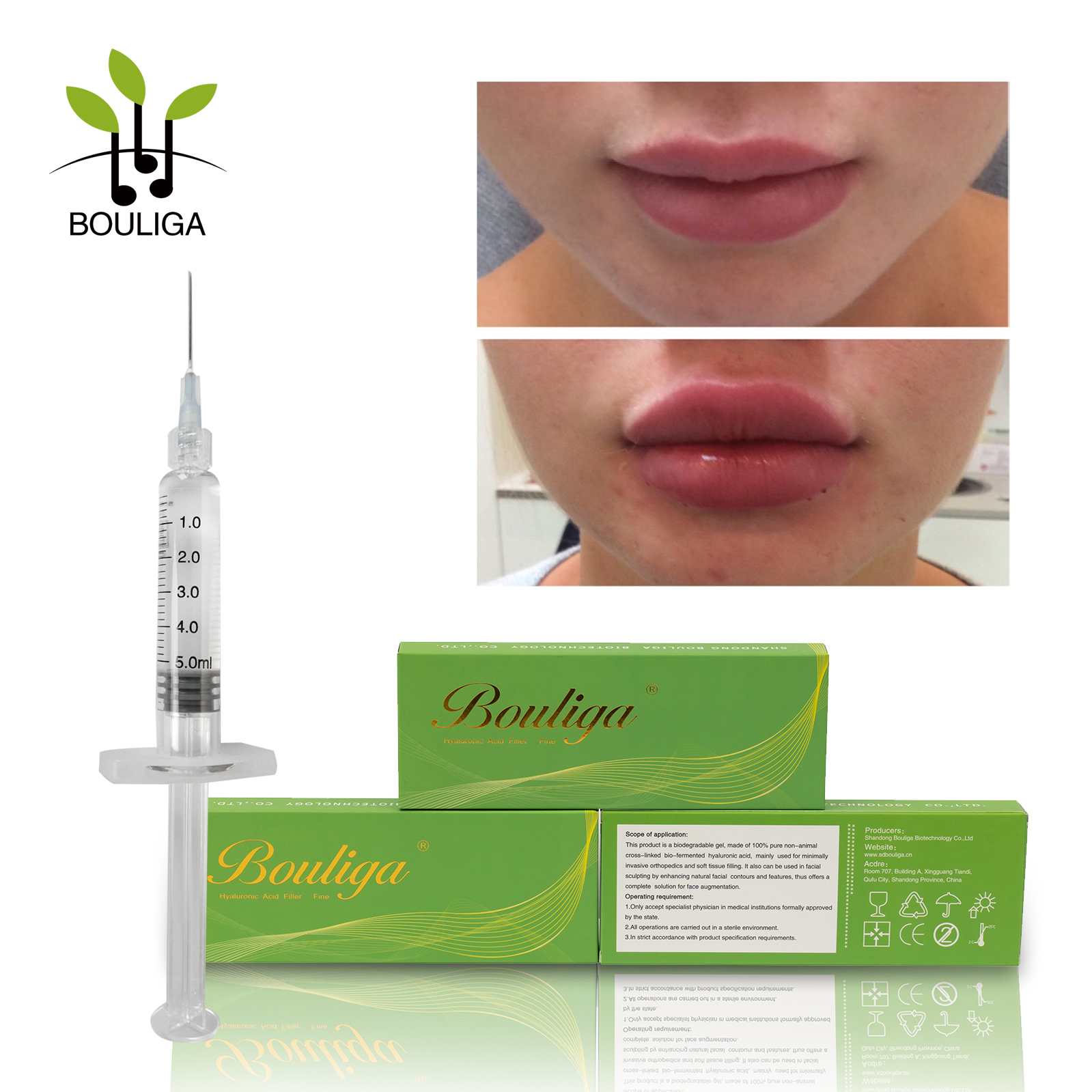 Bouliga Non-surgical Enhance Lips Filler 5ml Dermal Filler Non-Surgical 