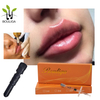 Lip Augmentation Volume Restoration Facial Fillers